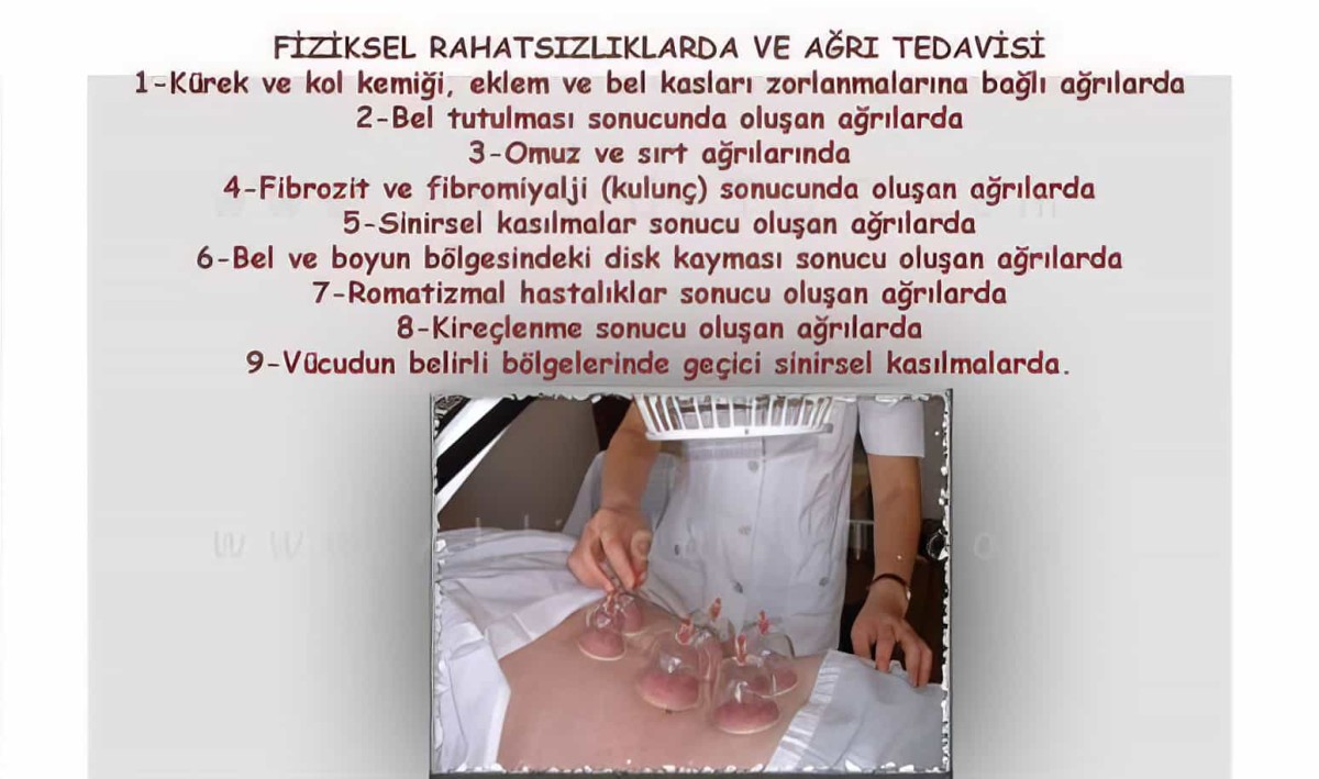 12 Parça Vakumlu Hacamat Kupa Çekme Seti Hacamax 1. Kalite - 4