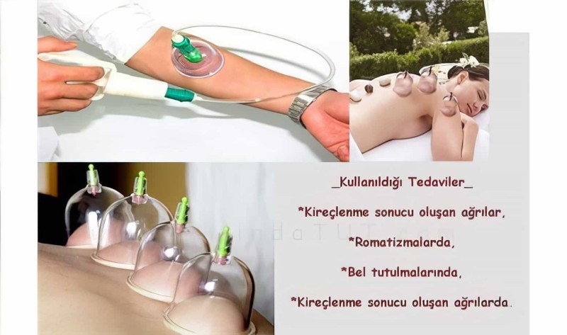 12 Parça Vakumlu Hacamat Kupa Çekme Seti Hacamax 1. Kalite - 5