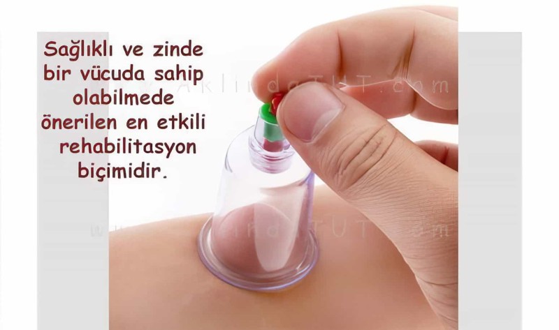 12 Parça Vakumlu Hacamat Kupa Çekme Seti Hacamax 1. Kalite - 6