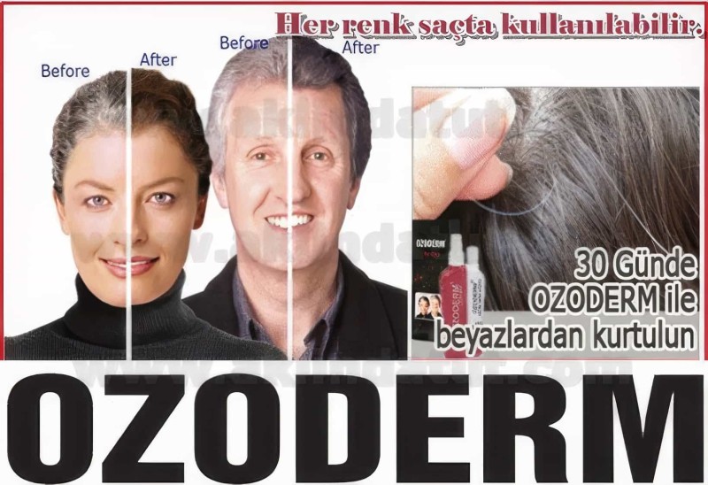 3 Adet Ozoderm 4'lü Saç Bakım Seti - 1