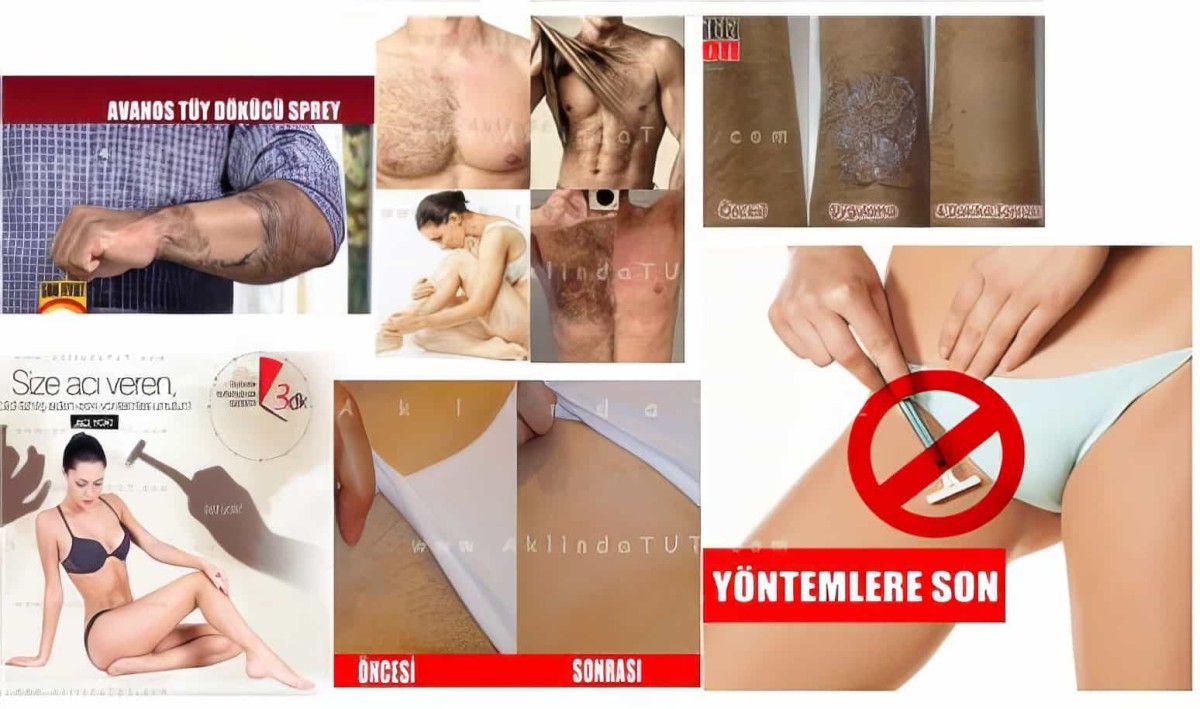 Avanos Tüy Dökücü Sprey 2 Adet 100ml - 4