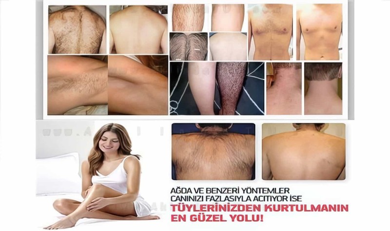 Avanos Tüy Dökücü Sprey 2 Adet 100ml - 6