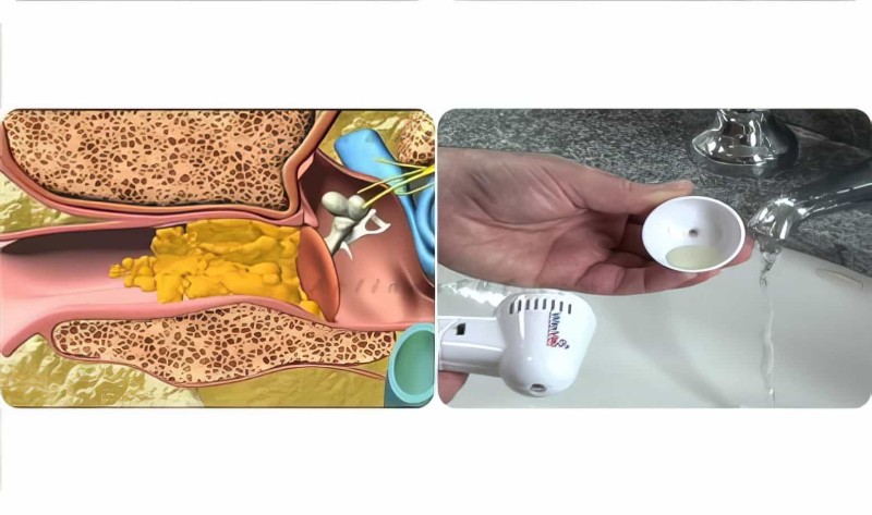 Vakumlu Kulak Temizleme Aleti Waxvac - 6
